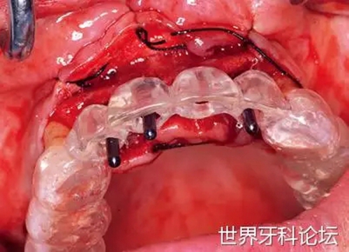 14.webp.jpg 14.webp.jpg