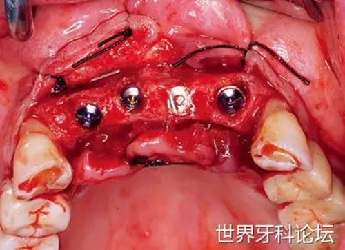 15.webp.jpg 15.webp.jpg