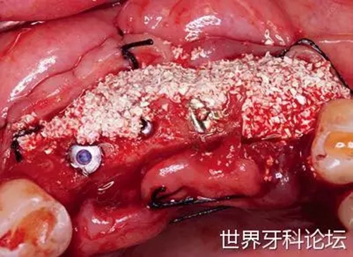 16.webp.jpg 16.webp.jpg