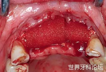 17.webp.jpg 17.webp.jpg