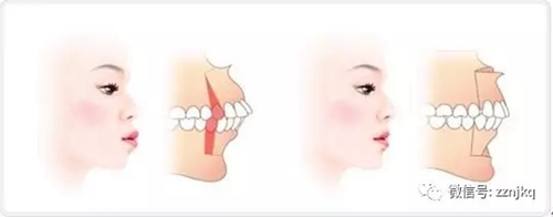 3.webp.jpg 3.webp.jpg