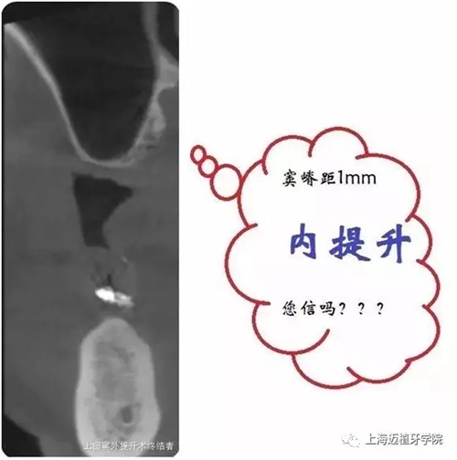 3.webp.jpg 3.webp.jpg