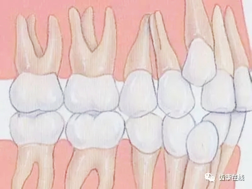 5.webp.jpg 5.webp.jpg