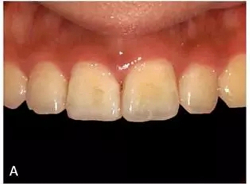 5.webp (1).jpg 5.webp (1).jpg