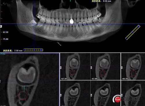 2.webp.jpg 2.webp.jpg