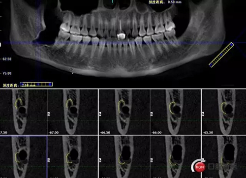 8.webp.jpg 8.webp.jpg