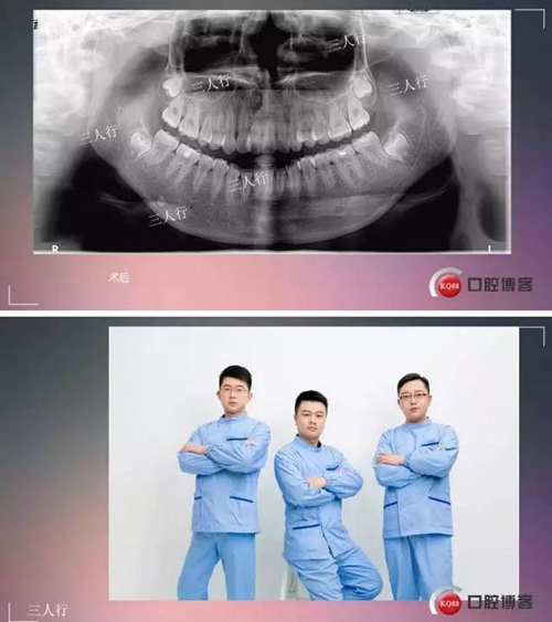 深部埋伏多生牙&mdash;&mdash;微創(chuàng)處理  