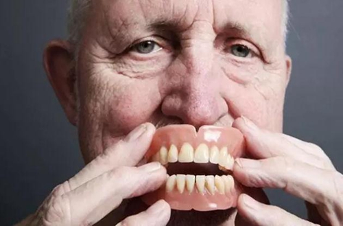 注意！假牙也會(huì)過(guò)期哦！   