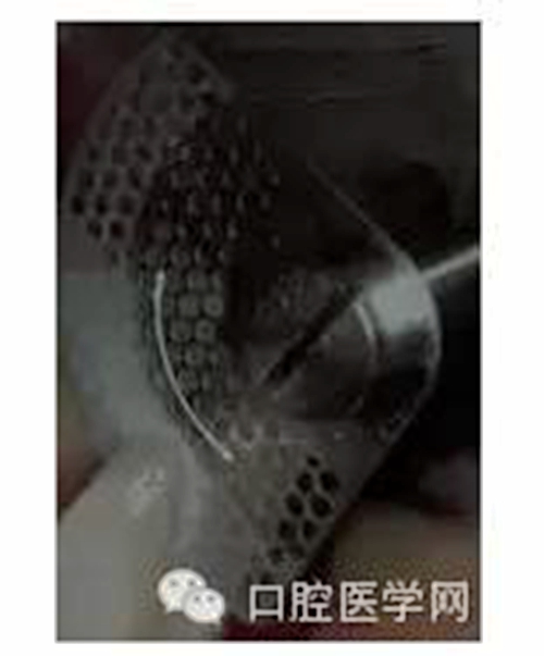 鄰面去釉的操作與注意事項(xiàng) 鄰面去釉的操作與注意事項(xiàng)