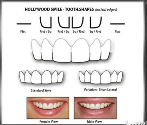 美學(xué)知識(shí)分享--切緣形態(tài)分類 美學(xué)知識(shí)分享--切緣形態(tài)分類