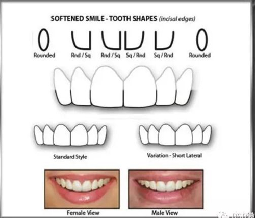 美學(xué)知識(shí)分享--切緣形態(tài)分類 美學(xué)知識(shí)分享--切緣形態(tài)分類