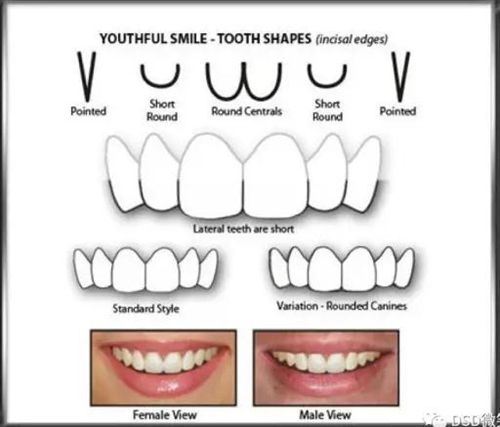 美學(xué)知識(shí)分享--切緣形態(tài)分類 美學(xué)知識(shí)分享--切緣形態(tài)分類