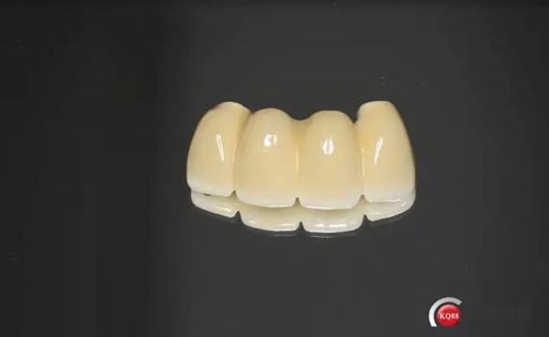 一例前牙重度牙周病8個月的種植漫長修復(fù) 一例前牙重度牙周病8個月的種植漫長修復(fù)