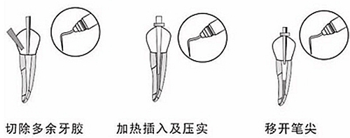 新熱熔充填系統(tǒng)C-Fill 新熱熔充填系統(tǒng)C-Fill