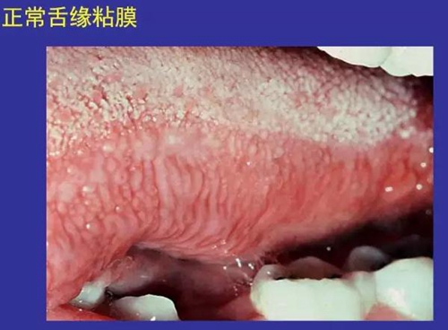 正?？谇火つぜ俺Ｒ姴p圖