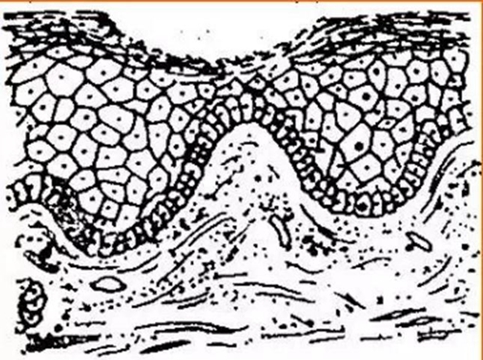 正?？谇火つぜ俺Ｒ姴p圖