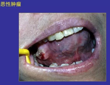 正?？谇火つぜ俺Ｒ姴p圖