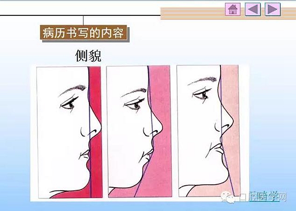 口腔正畸學病歷書寫 口腔正畸學病歷書寫