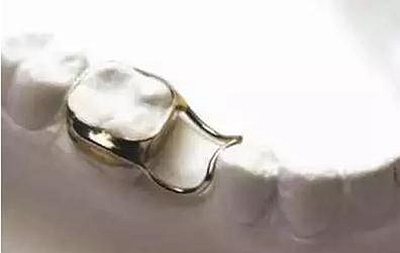 間隙保持器的應(yīng)用 間隙保持器的應(yīng)用