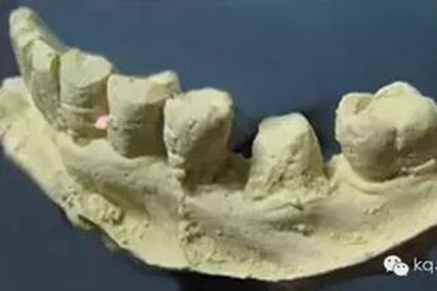 義齒加工技師想對醫(yī)生說的話 義齒加工技師想對醫(yī)生說的話