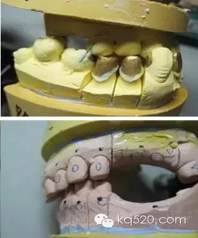 義齒加工技師想對醫(yī)生說的話 義齒加工技師想對醫(yī)生說的話