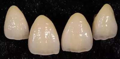 義齒加工技師想對醫(yī)生說的話 義齒加工技師想對醫(yī)生說的話