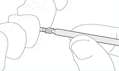 Icon 愛康滲透樹脂使用說(shuō)明書 Icon 愛康滲透樹脂使用說(shuō)明書