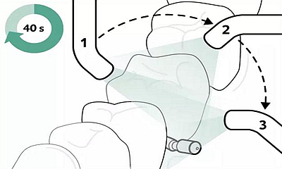 Icon 愛康滲透樹脂使用說(shuō)明書 Icon 愛康滲透樹脂使用說(shuō)明書