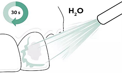Icon 愛康滲透樹脂使用說(shuō)明書 Icon 愛康滲透樹脂使用說(shuō)明書