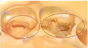 這10種情況下要重新取硅橡膠模型 這10種情況下要重新取硅橡膠模型