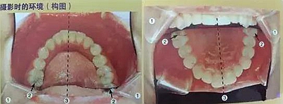口腔攝影方法與技巧 口腔攝影方法與技巧
