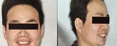 口腔攝影方法與技巧 口腔攝影方法與技巧