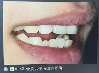 口腔攝影方法與技巧 口腔攝影方法與技巧