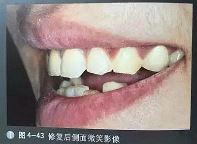 口腔攝影方法與技巧 口腔攝影方法與技巧