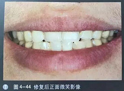 口腔攝影方法與技巧 口腔攝影方法與技巧