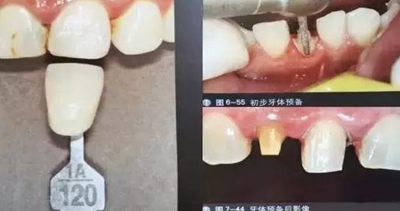 口腔攝影方法與技巧 口腔攝影方法與技巧