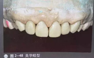 口腔攝影方法與技巧 口腔攝影方法與技巧