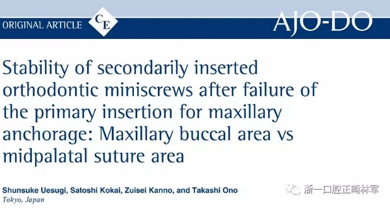 正畸文獻閱讀--上頜支抗初次植入失敗后二次植入穩(wěn)定性的研究 正畸文獻閱讀--上頜支抗初次植入失敗后二次植入穩(wěn)定性的研究