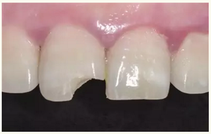 顯微知著 從齒開始&mdash;&mdash;上海第九人民醫(yī)院牙體牙髓科