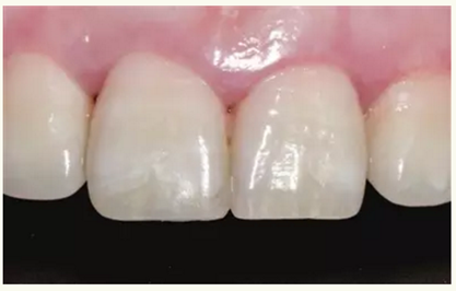 顯微知著 從齒開始&mdash;&mdash;上海第九人民醫(yī)院牙體牙髓科