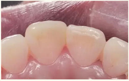 顯微知著 從齒開始&mdash;&mdash;上海第九人民醫(yī)院牙體牙髓科