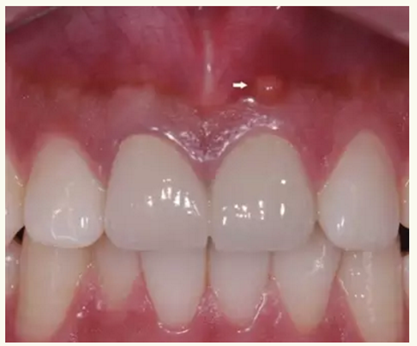 顯微知著 從齒開始&mdash;&mdash;上海第九人民醫(yī)院牙體牙髓科