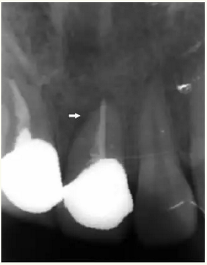 顯微知著 從齒開始&mdash;&mdash;上海第九人民醫(yī)院牙體牙髓科