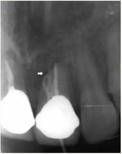顯微知著 從齒開始&mdash;&mdash;上海第九人民醫(yī)院牙體牙髓科