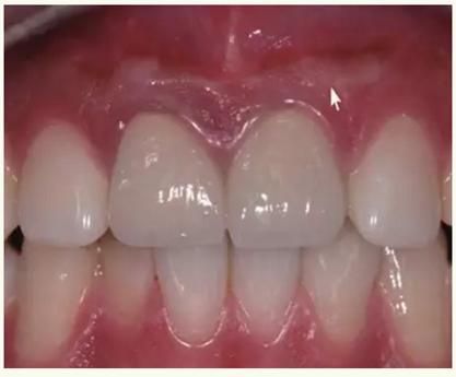 顯微知著 從齒開始&mdash;&mdash;上海第九人民醫(yī)院牙體牙髓科