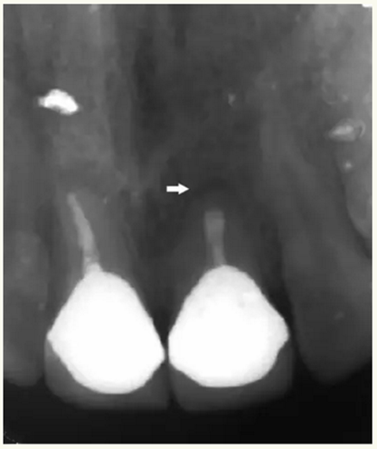 顯微知著 從齒開始&mdash;&mdash;上海第九人民醫(yī)院牙體牙髓科
