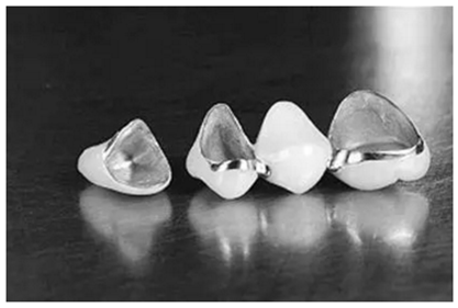 醫(yī)生，我的烤瓷牙上有個黑線怎么回事？