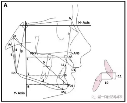 正畸矯正 正畸矯正