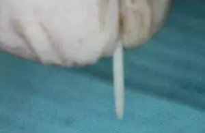 纖維樁修復(fù)之精細(xì)操作 纖維樁修復(fù)之精細(xì)操作