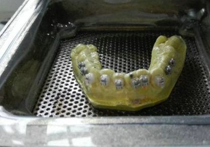 【原創(chuàng)博客】淺談間接粘托槽托槽的方法與技巧 【原創(chuàng)博客】淺談間接粘托槽托槽的方法與技巧